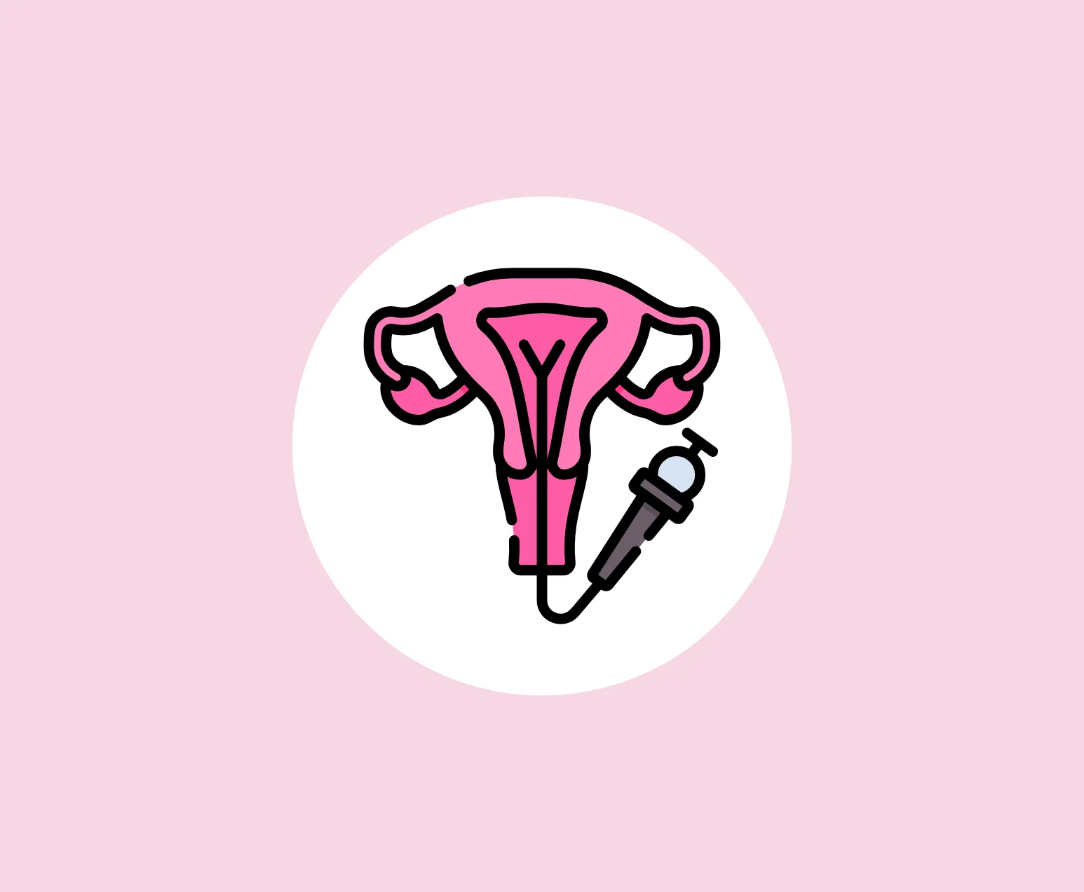 Hysteroscopy Treatment Hyderabad