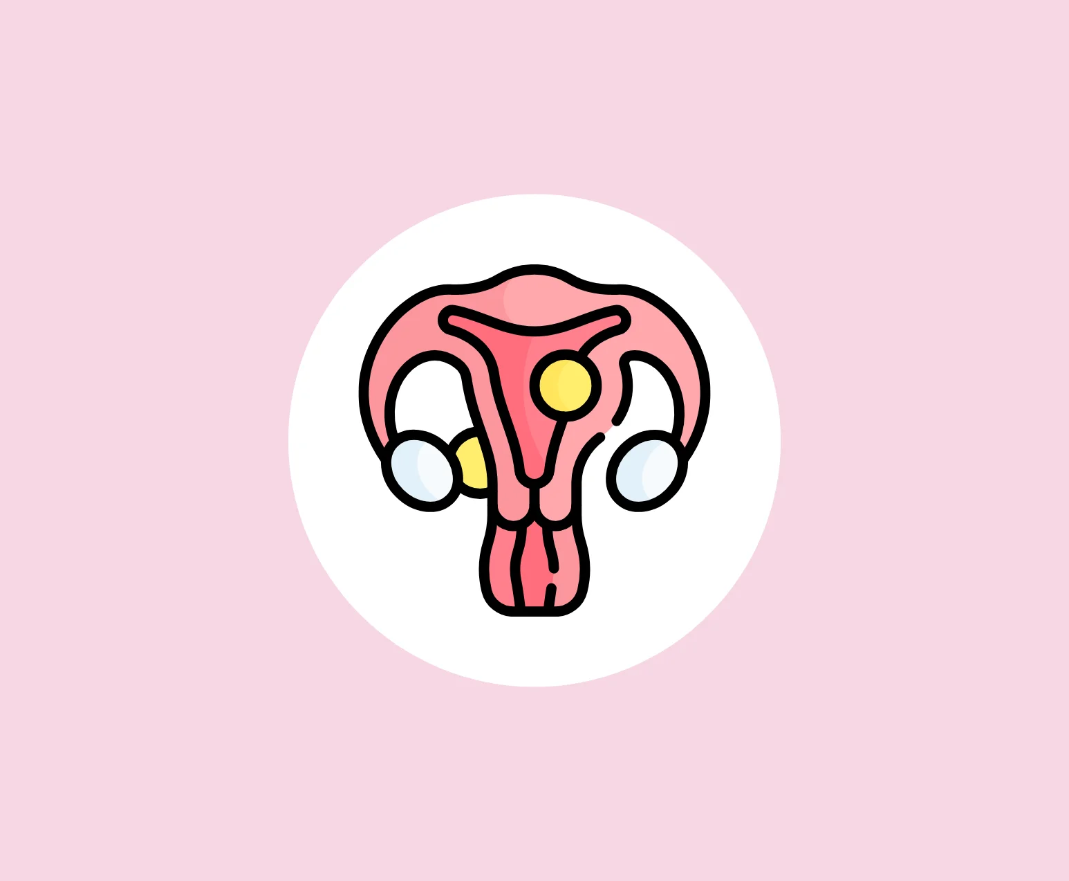 Endometriosis & Fibroids Treatment Hyderabad