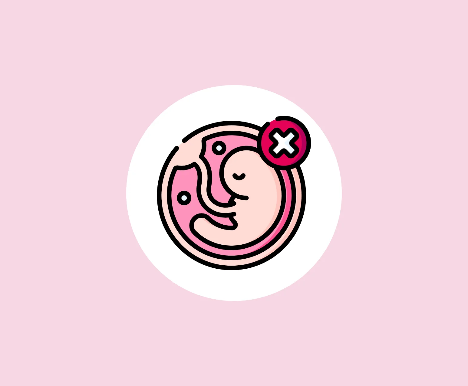 Recurrent Abortion Services Hyderabad